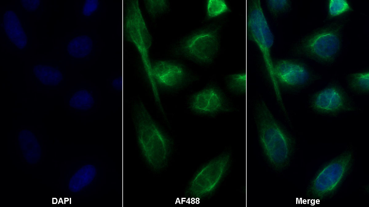 Monoclonal Antibody to Alpha-1-Antitrypsin (a1AT)