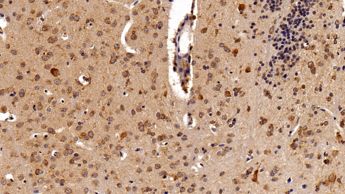 Monoclonal Antibody to Signal Transducer And Activator Of Transcription 3 (STAT3)