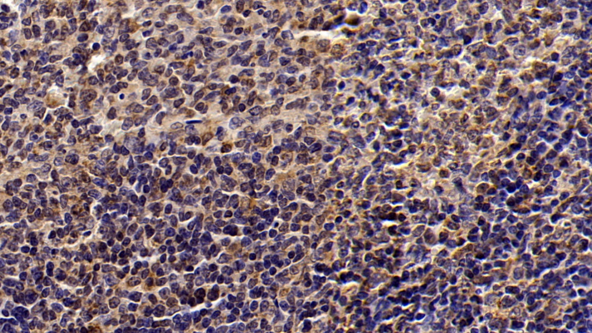 Monoclonal Antibody to Signal Transducer And Activator Of Transcription 3 (STAT3)