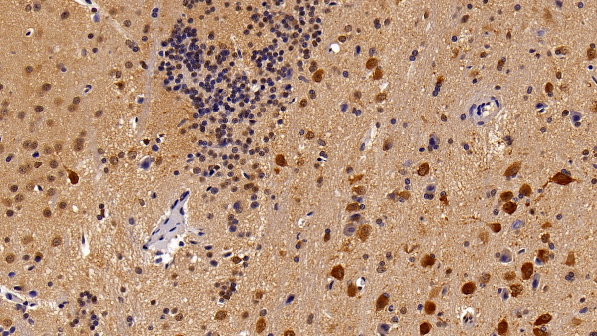 Monoclonal Antibody to Signal Transducer And Activator Of Transcription 3 (STAT3)