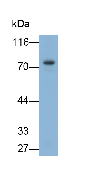 Monoclonal Antibody to Transglutaminase 3, Epidermal (TGM3)
