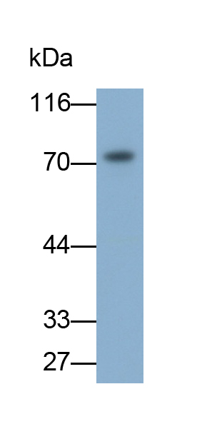 Monoclonal Antibody to Transglutaminase 3, Epidermal (TGM3)