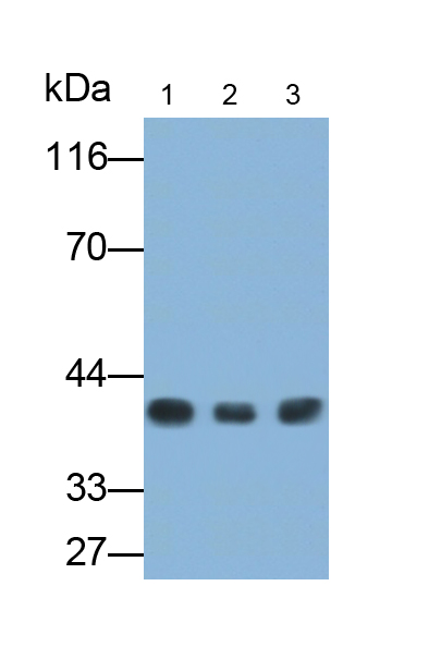 Monoclonal Antibody to Inhibin Beta B (INHbB)