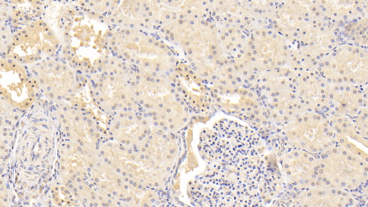 Monoclonal Antibody to Inhibin Beta B (INHbB)