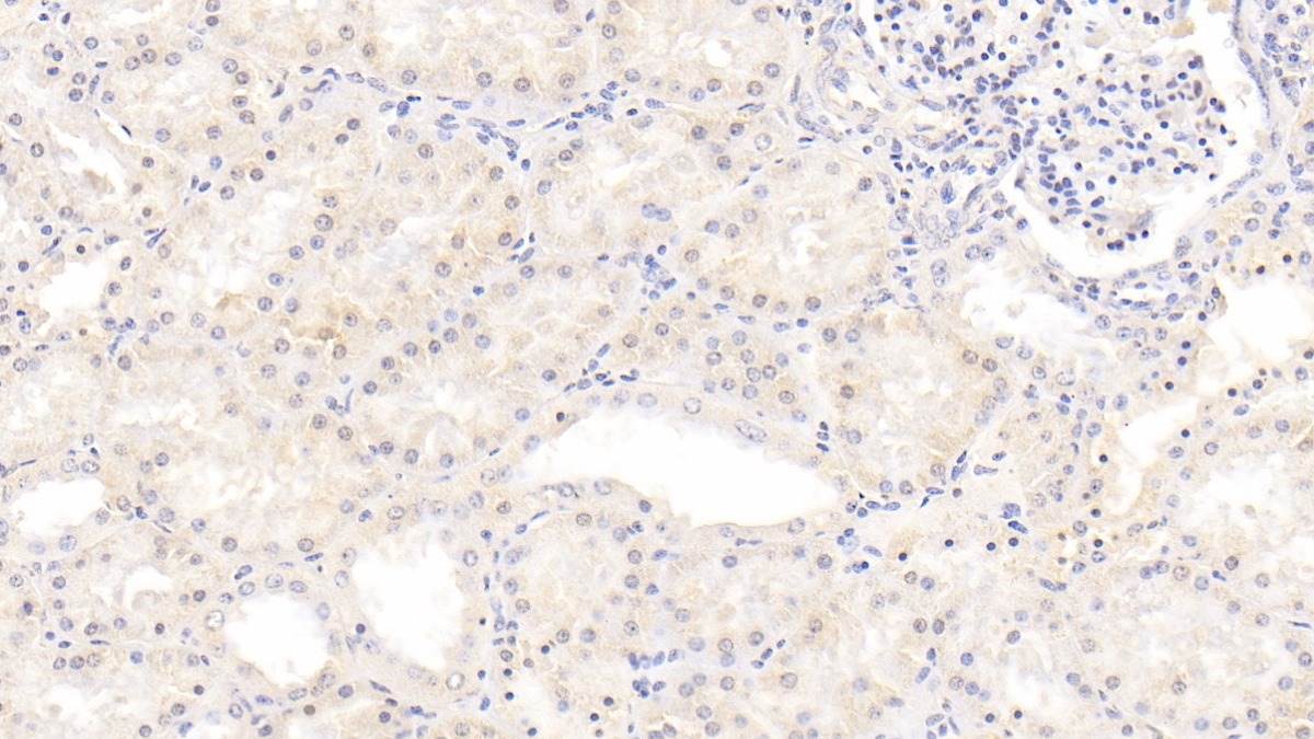 Monoclonal Antibody to Inhibin Beta B (INHbB)