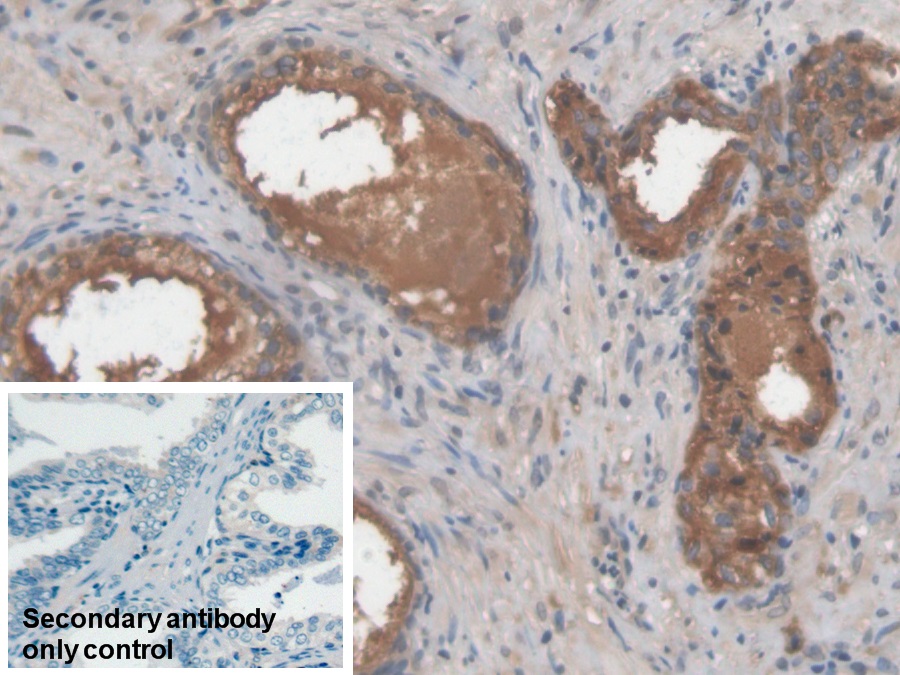 Monoclonal Antibody to Lectin Galactoside Binding, Soluble 3 Binding Protein (LGALS3BP)