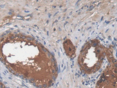 Monoclonal Antibody to Lectin Galactoside Binding, Soluble 3 Binding Protein (LGALS3BP)