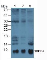 Monoclonal Antibody to S100 Calcium Binding Protein A6 (S100A6)