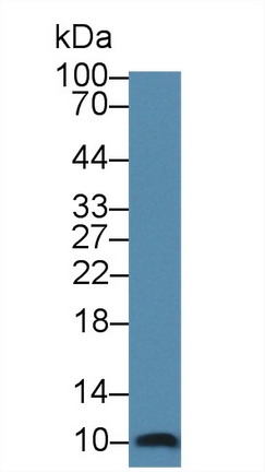 Monoclonal Antibody to S100 Calcium Binding Protein A6 (S100A6)