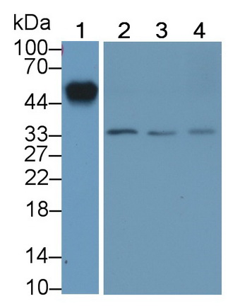 Monoclonal Antibody to Orosomucoid 2 (ORM2)