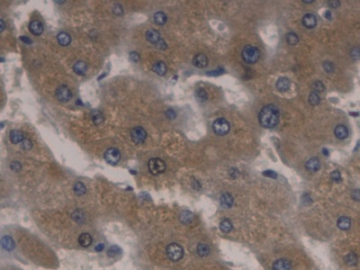 Monoclonal Antibody to Orosomucoid 2 (ORM2)