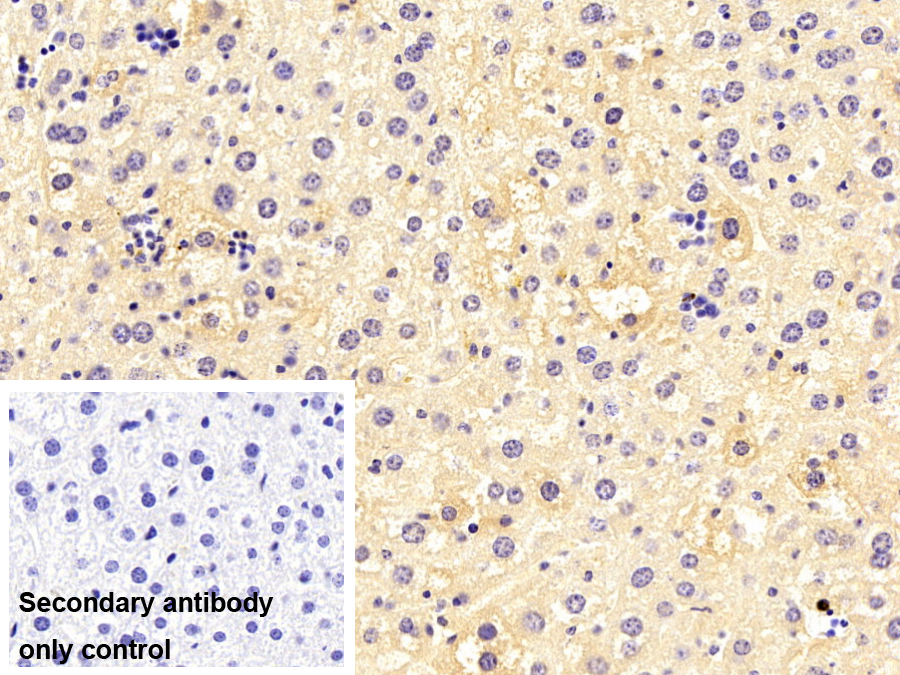 Monoclonal Antibody to Orosomucoid 2 (ORM2)
