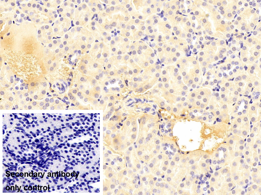 Monoclonal Antibody to Orosomucoid 2 (ORM2)