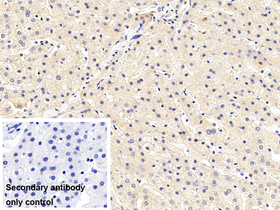 Monoclonal Antibody to Orosomucoid 2 (ORM2)