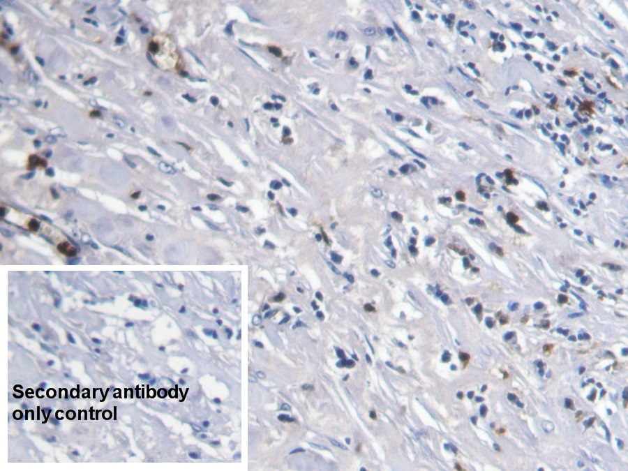 Monoclonal Antibody to S100 Calcium Binding Protein A8 (S100A8)