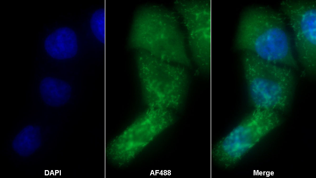 Monoclonal Antibody to S100 Calcium Binding Protein A8 (S100A8)