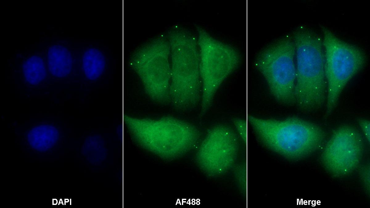 Monoclonal Antibody to S100 Calcium Binding Protein A8 (S100A8)