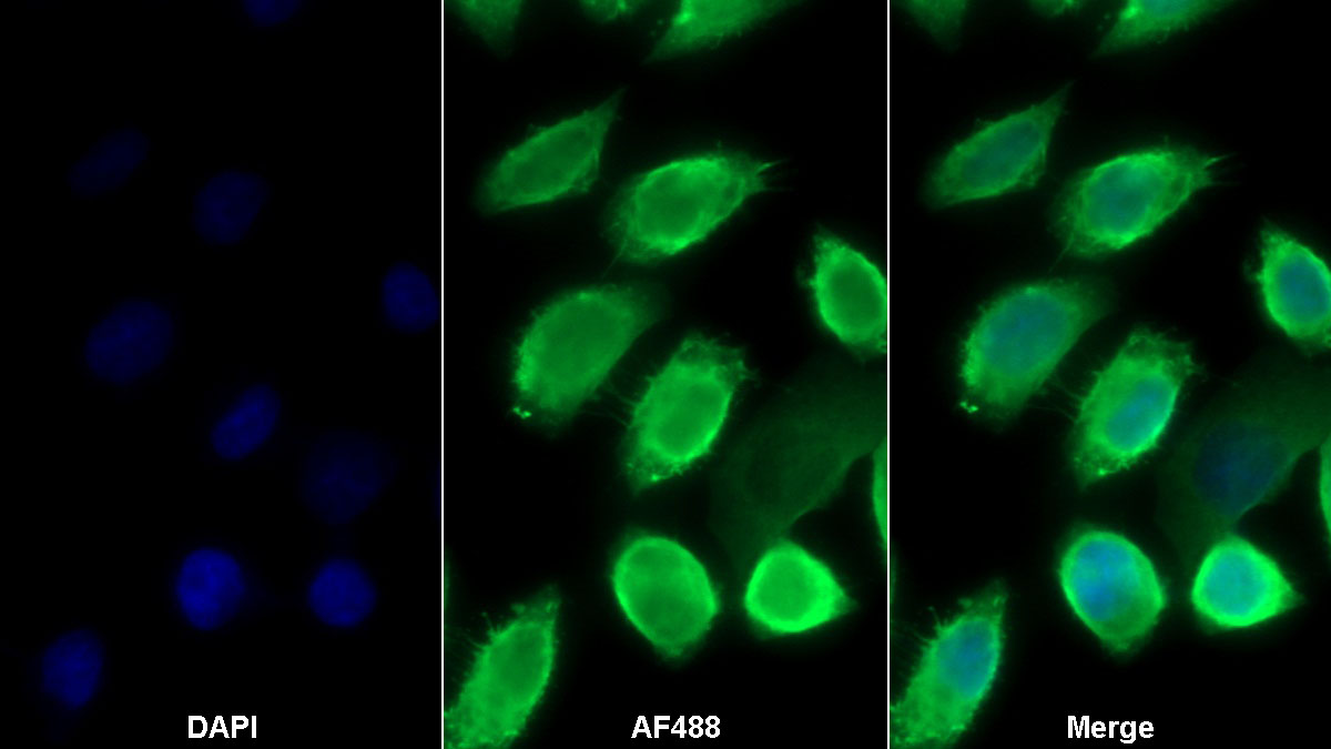 Monoclonal Antibody to S100 Calcium Binding Protein A8 (S100A8)