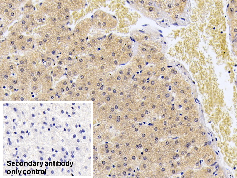 Monoclonal Antibody to S100 Calcium Binding Protein A9 (S100A9)