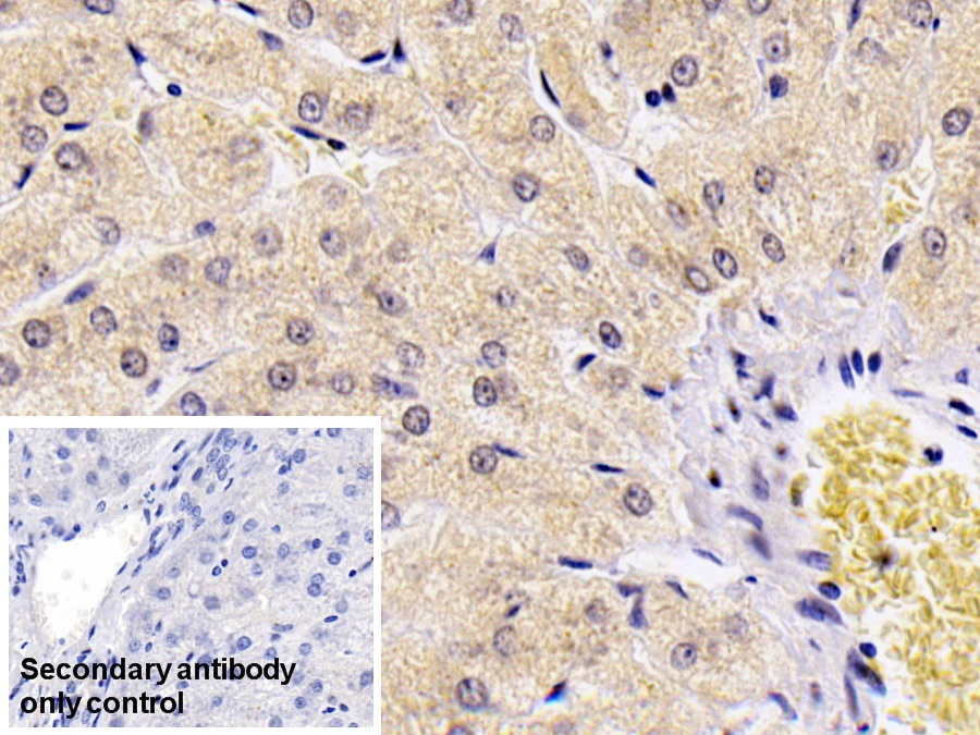 Monoclonal Antibody to S100 Calcium Binding Protein A9 (S100A9)