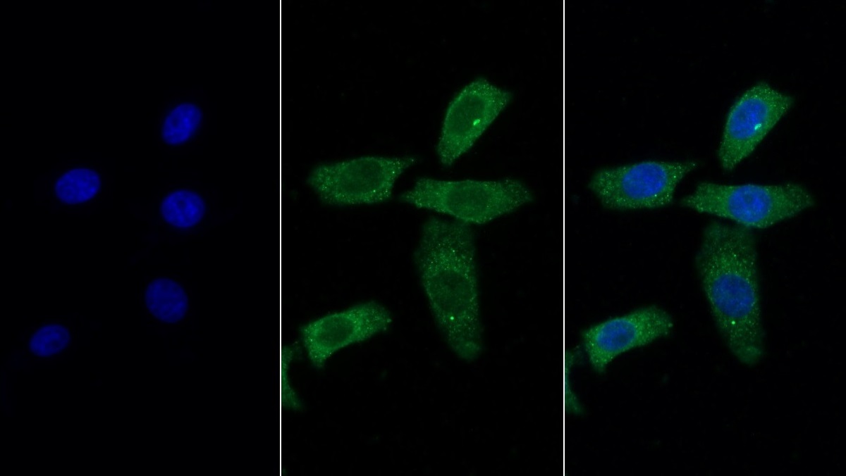 Monoclonal Antibody to S100 Calcium Binding Protein A9 (S100A9)