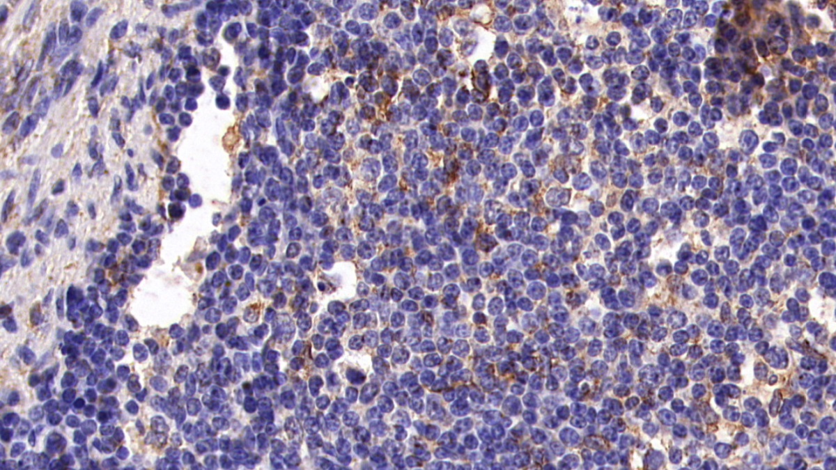 Monoclonal Antibody to Cluster Of Differentiation 5 (CD5)