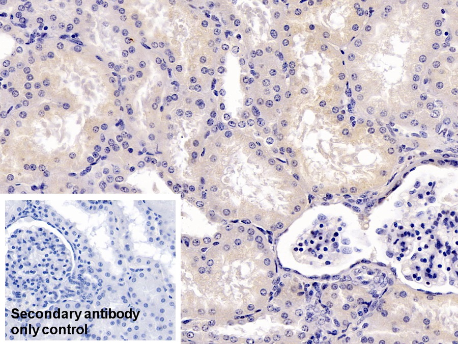 Monoclonal Antibody to Vitamin D Binding Protein (DBP)