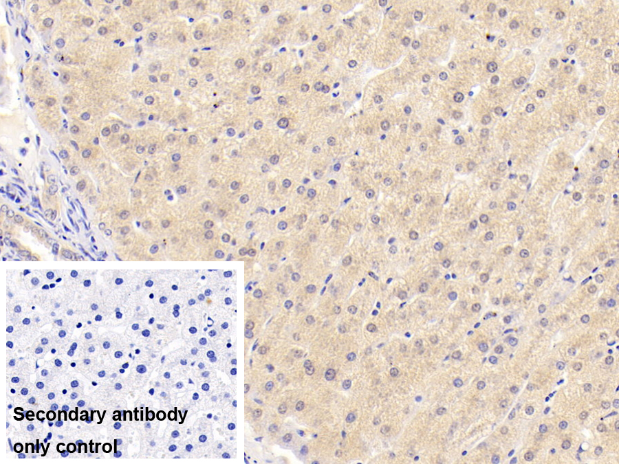 Monoclonal Antibody to Vitamin D Binding Protein (DBP)