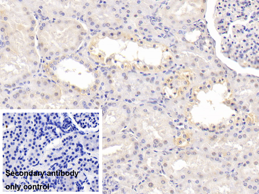 Monoclonal Antibody to Vitamin D Binding Protein (DBP)