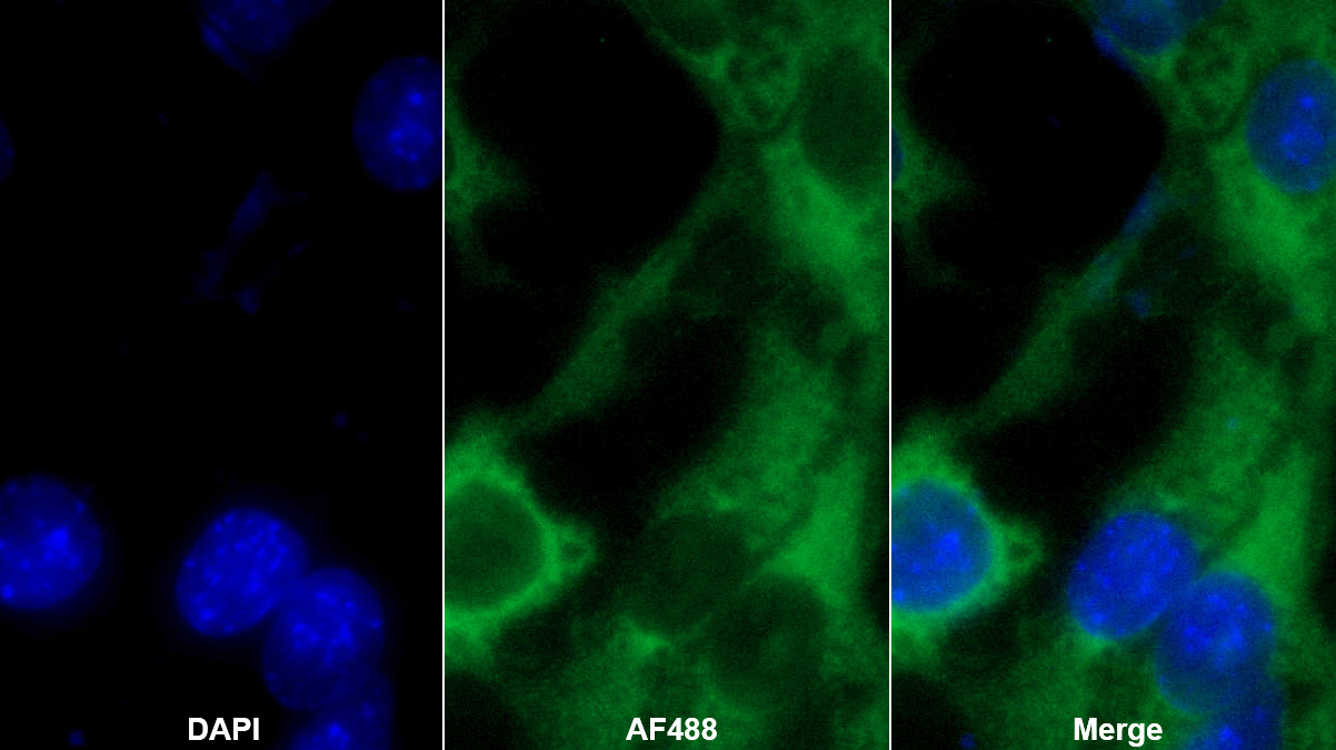Monoclonal Antibody to Vitamin D Binding Protein (DBP)