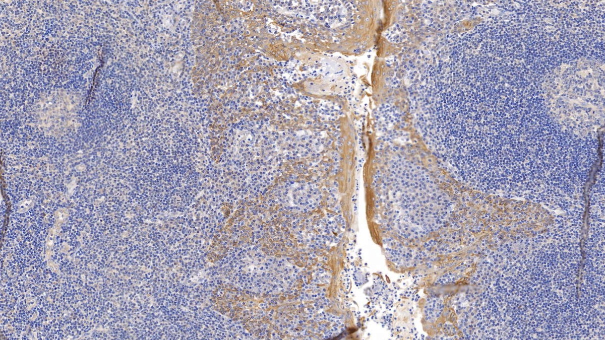 Monoclonal Antibody to Cytokeratin 17 (CK17)