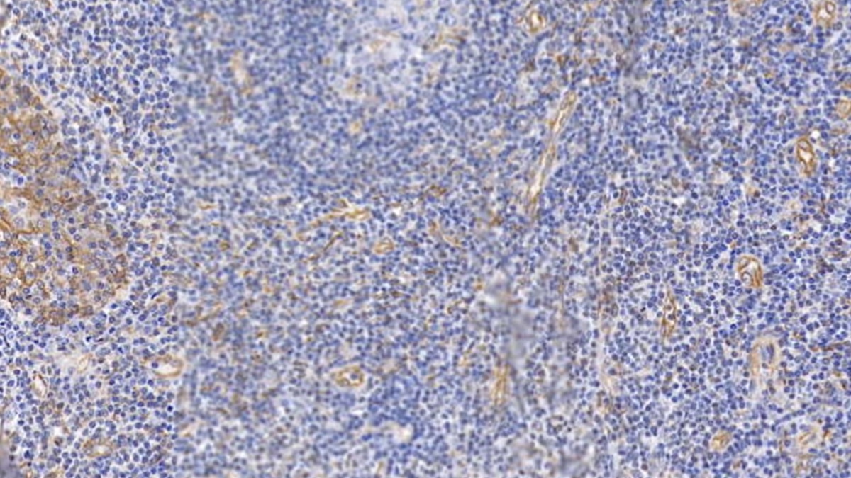 Monoclonal Antibody to Cytokeratin 17 (CK17)