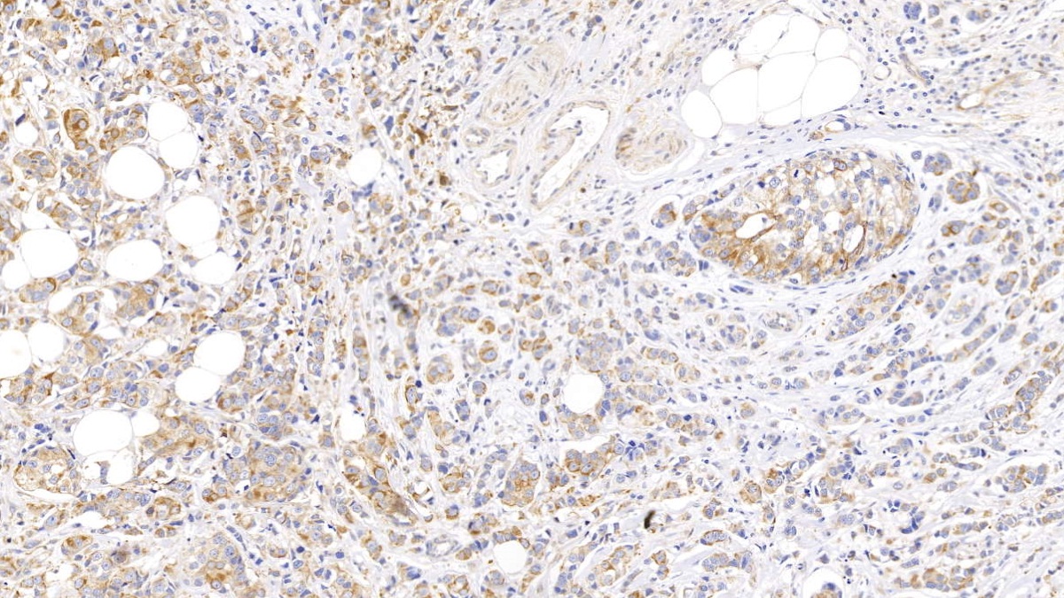 Monoclonal Antibody to Cytokeratin 17 (CK17)