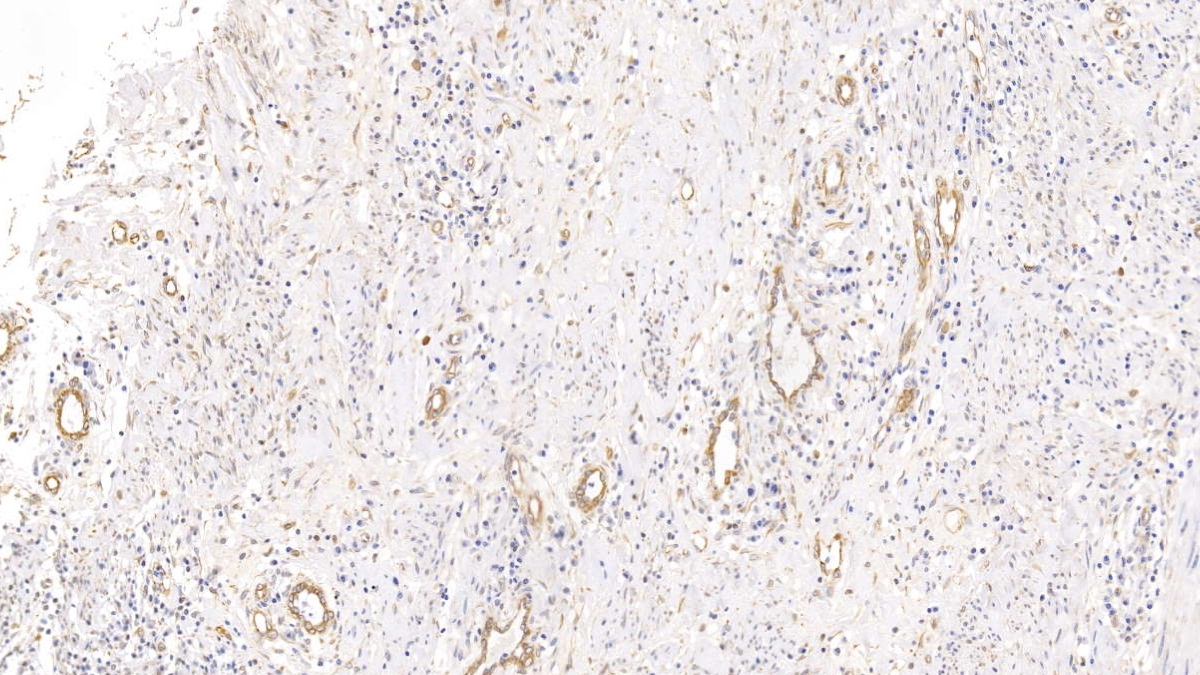 Monoclonal Antibody to Cytokeratin 17 (CK17)