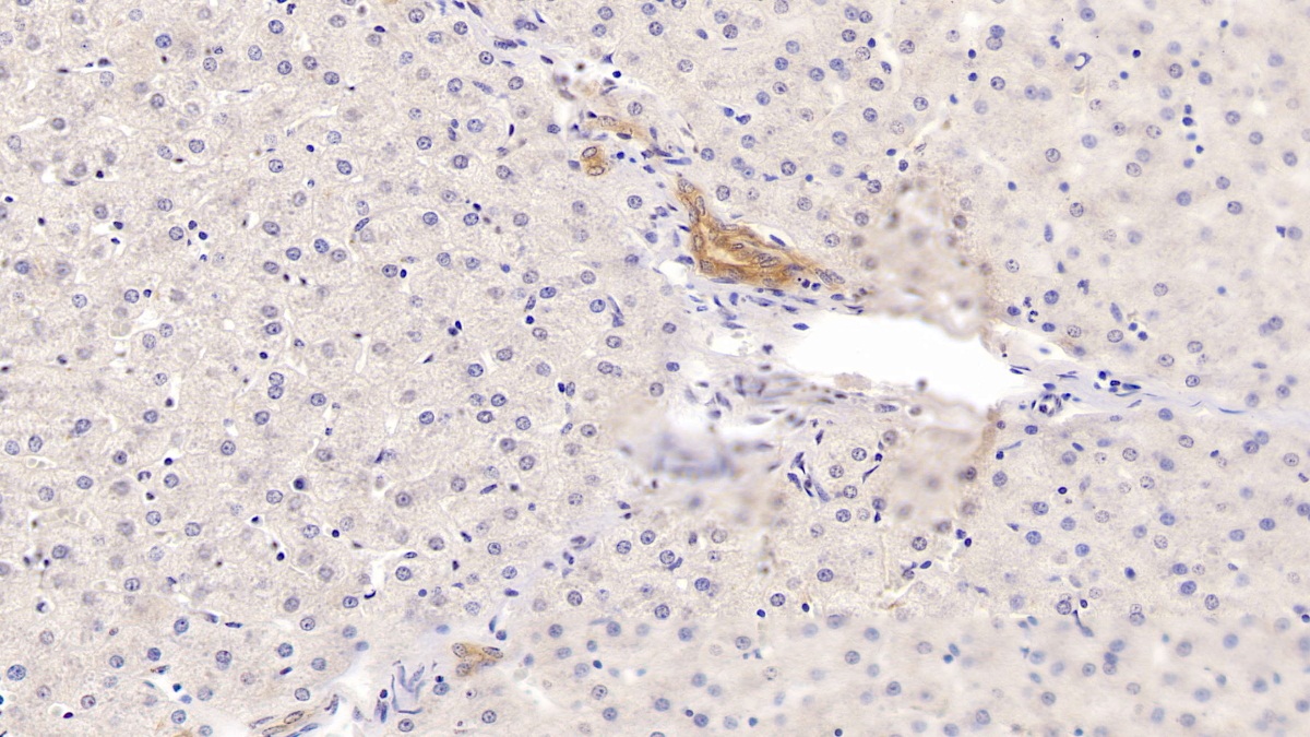 Monoclonal Antibody to Cytokeratin 17 (CK17)