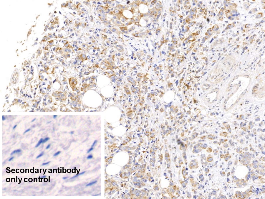 Monoclonal Antibody to Cytokeratin 17 (CK17)