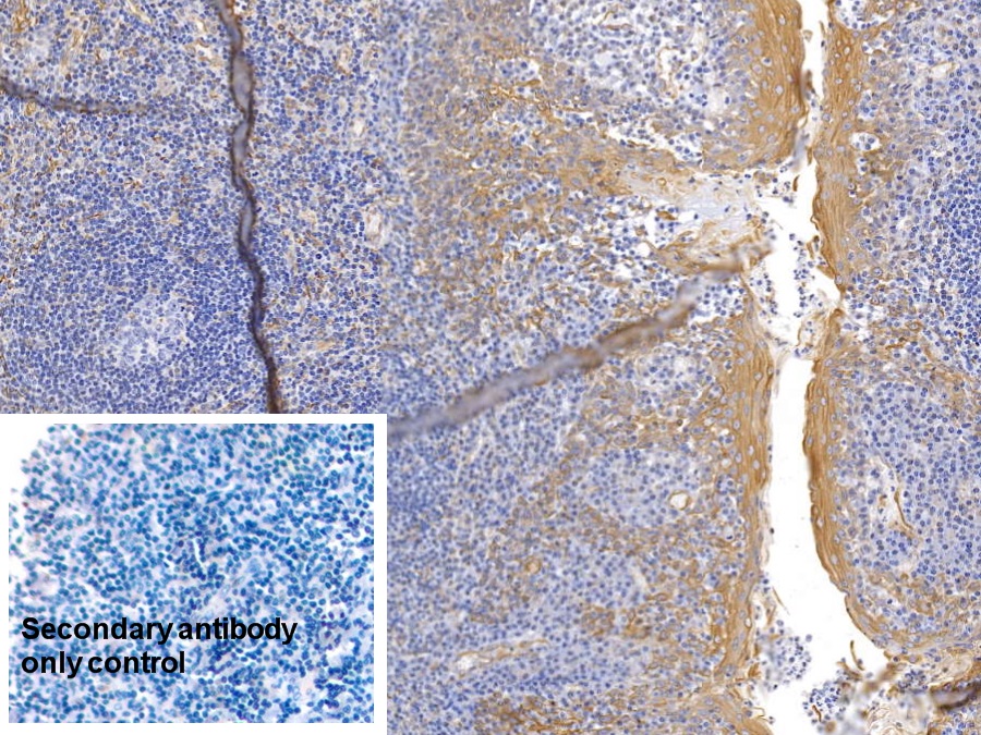 Monoclonal Antibody to Cytokeratin 17 (CK17)