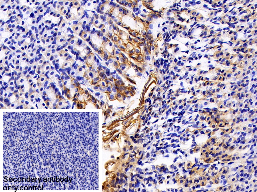 Monoclonal Antibody to Cytokeratin 17 (CK17)