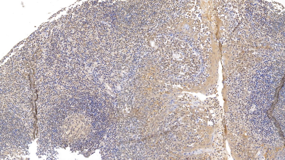 Monoclonal Antibody to Cytokeratin 17 (CK17)