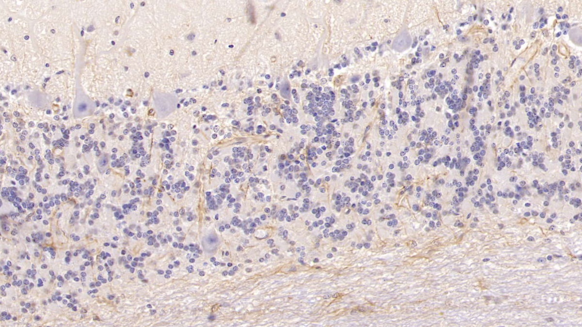 Monoclonal Antibody to Cytokeratin 17 (CK17)