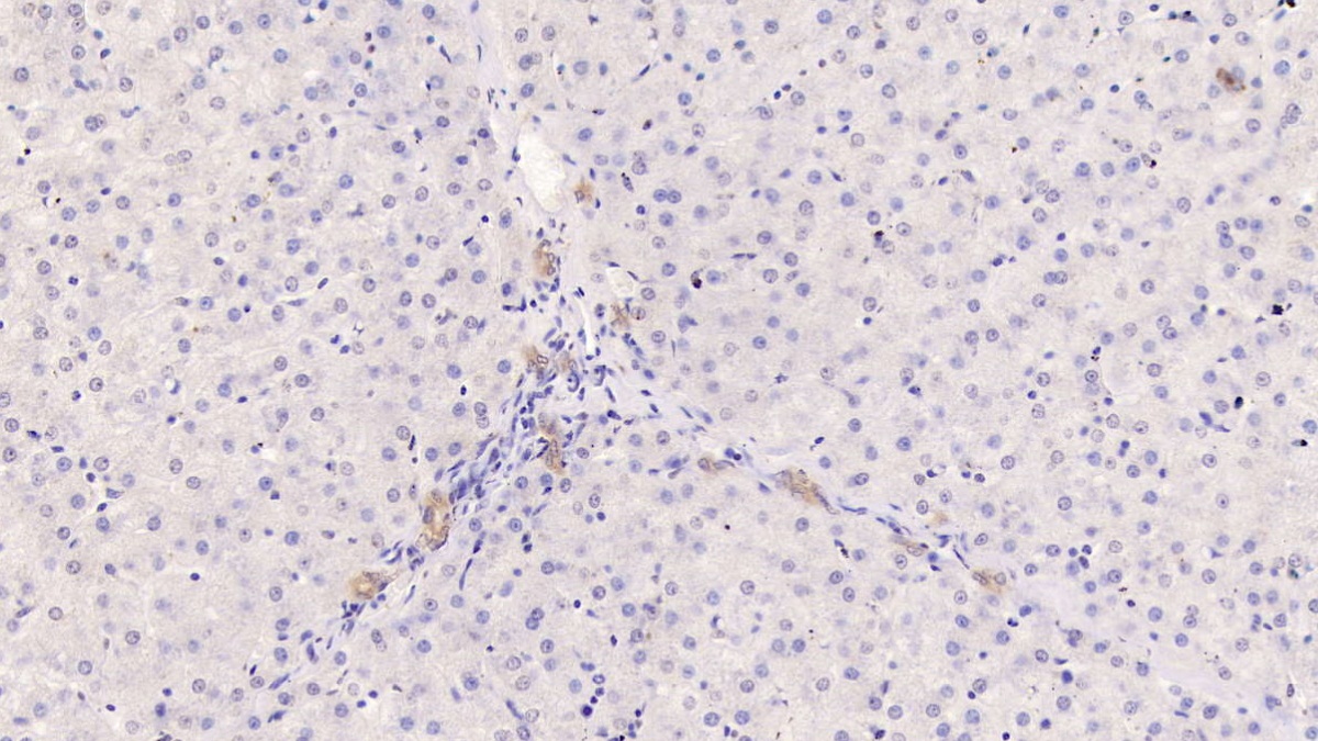 Monoclonal Antibody to Cytokeratin 17 (CK17)