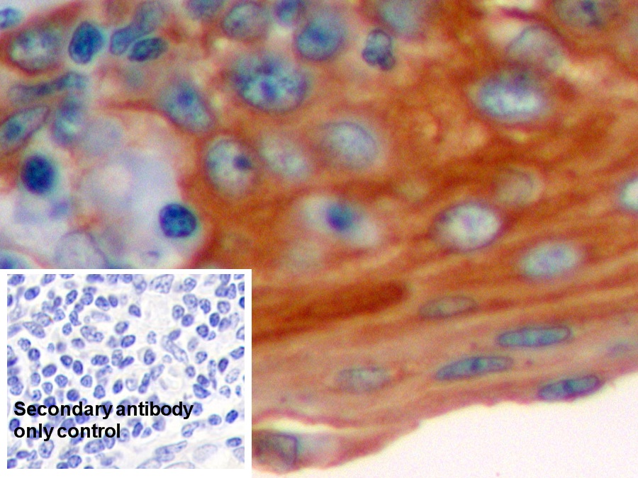 Monoclonal Antibody to Cytokeratin 17 (CK17)