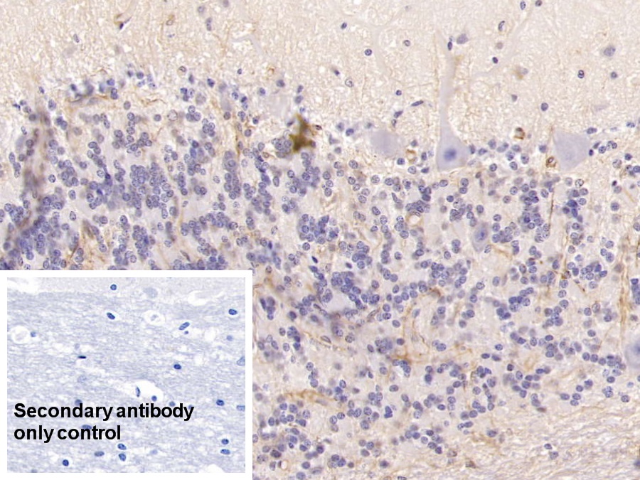 Monoclonal Antibody to Cytokeratin 17 (CK17)