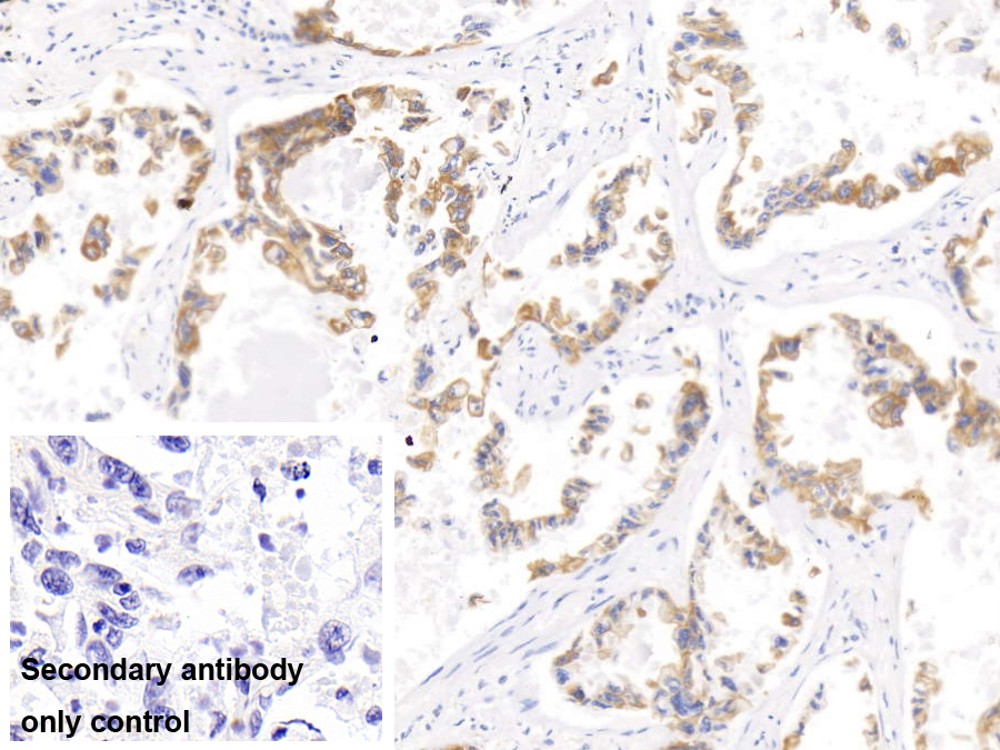 Monoclonal Antibody to Cytokeratin 17 (CK17)