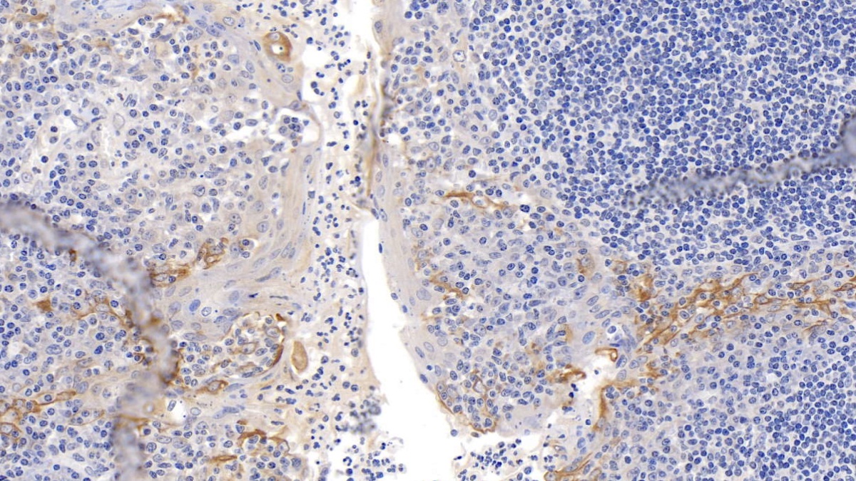 Monoclonal Antibody to Cytokeratin 17 (CK17)