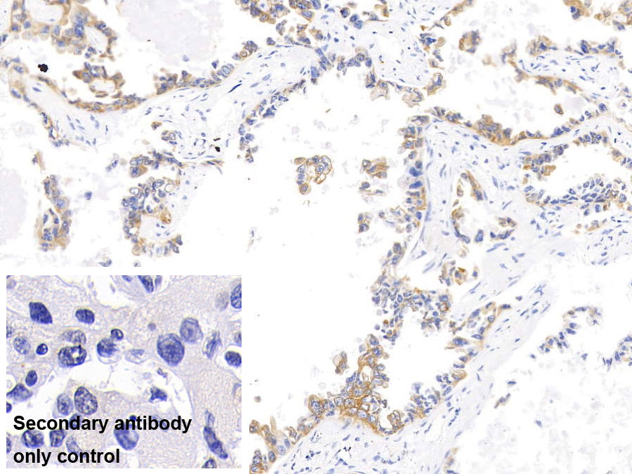 Monoclonal Antibody to Cytokeratin 17 (CK17)