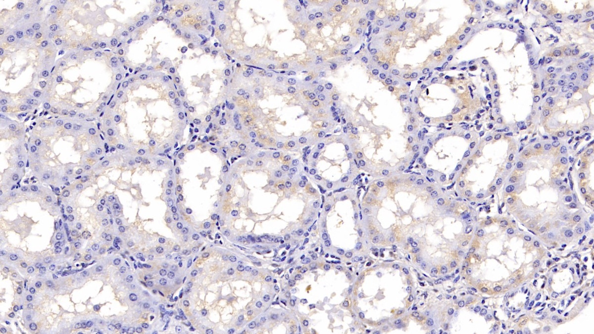 Monoclonal Antibody to Hedgehog Homolog, Sonic (SHH)