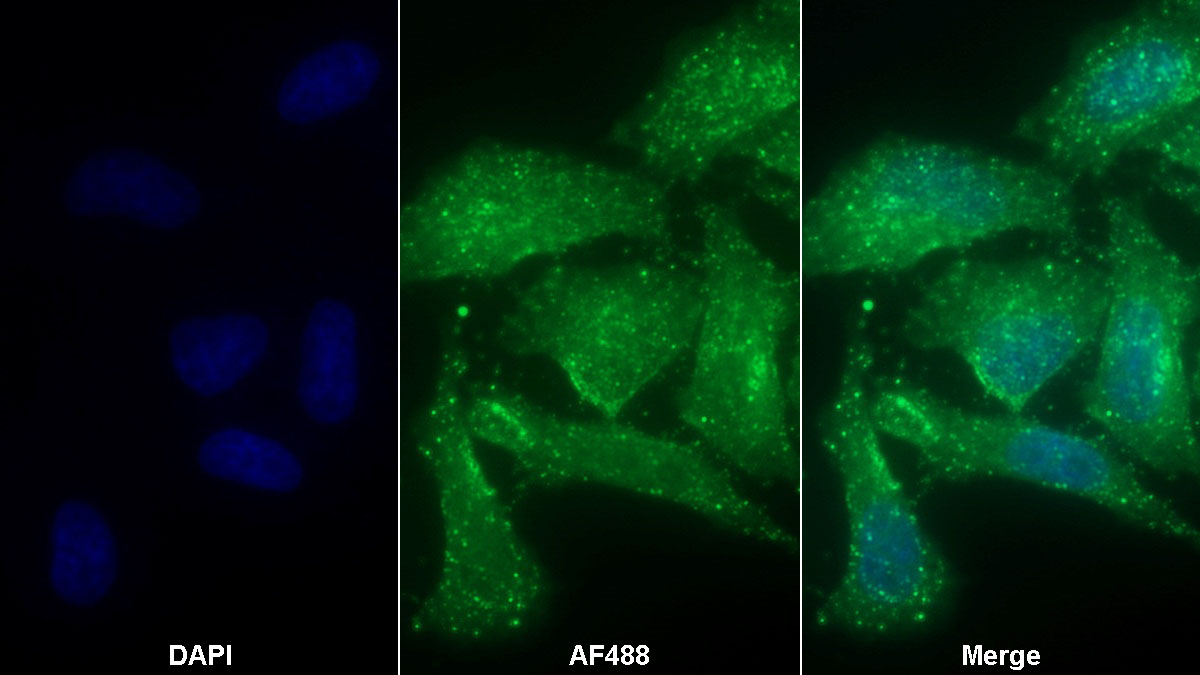 Monoclonal Antibody to Coagulation Factor XI (F11)