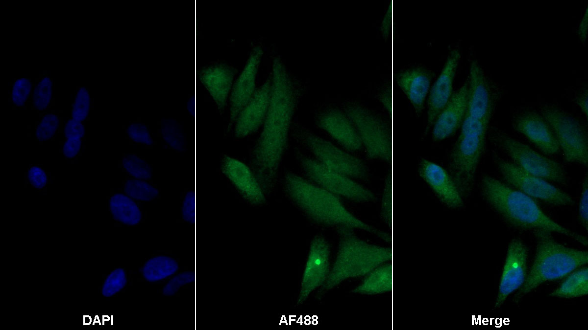 Monoclonal Antibody to Coagulation Factor XI (F11)