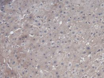 Monoclonal Antibody to Vascular Endothelial Growth Factor 121 (VEGF121)